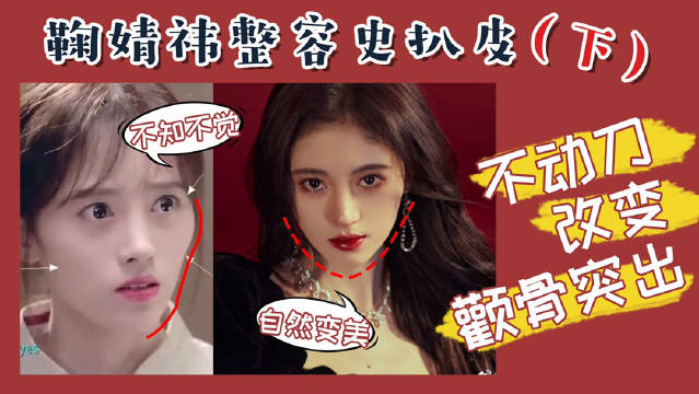 鞠婧祎#鞠婧祎整容##整形##鞠婧祎仿妆#...